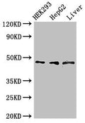 Western Blot
Positive WB detected in: HEK293 whole cell lysate, HepG2 whole cell lysate, Rat liver tissue
All lanes: ACADSB antibody at 3µg/ml
Secondary
Goat polyclonal to rabbit IgG at 1/50000 dilution
Predicted band size: 48, 37 kDa
Observed band size: 48 kDa