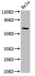 Western Blot
Positive WB detected in: Hela whole cell lysate
All lanes: ACADVL antibody at 2ug/ml
Secondary
Goat polyclonal to rabbit IgG at 1/50000 dilution
Predicted band size: 71, 69, 73 kDa
Observed band size: 71 kDa
