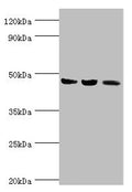Western blot All lanes: ACAT1 antibody at 6µg/ml Lane 1: Mouse skeletal musce tissue Lane 2: Rat heart tissue Lane 3: THP-1 whole cell lysate Secondary Goat polyclonal to rabbit IgG at 1/10000 dilution Predicted band size: 46, 18 kDa Observed band size: 46 kDa