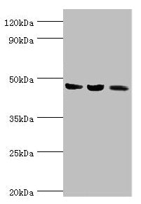 Western blot All lanes: ACAT1 antibody at 6µg/ml Lane 1: Mouse skeletal musce tissue Lane 2: Rat heart tissue Lane 3: THP-1 whole cell lysate Secondary Goat polyclonal to rabbit IgG at 1/10000 dilution Predicted band size: 46, 18 kDa Observed band size: 46 kDa