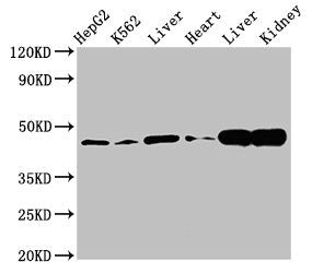 Western Blot
Positive WB detected in: HepG2 whole cell lysate, K562 whole cell lysate, Rat liver tissue, Mouse heart tissue, Mouse liver tissue Mouse kindey tissue
All lanes: ACAT1 antibody at 3µg/ml
Secondary
Goat polyclonal to rabbit IgG at 1/50000 dilution
Predicted band size: 46, 18 kDa
Observed band size: 46 kDa