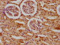 IHC image of CSB-PA001149LA01RA diluted at 1:400 and staining in paraffin-embedded rat kidney tissue performed on a Leica BondTM system. After dewaxing and hydration, antigen retrieval was mediated by high pressure in a citrate buffer (pH 6.0). Section was blocked with 10% normal goat serum 30min at RT. Then primary antibody (1% BSA) was incubated at 4°C overnight. The primary is detected by a biotinylated secondary antibody and visualized using an HRP conjugated SP system.