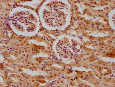 IHC image of CSB-PA001149LA01RA diluted at 1:400 and staining in paraffin-embedded rat kidney tissue performed on a Leica BondTM system. After dewaxing and hydration, antigen retrieval was mediated by high pressure in a citrate buffer (pH 6.0). Section was blocked with 10% normal goat serum 30min at RT. Then primary antibody (1% BSA) was incubated at 4°C overnight. The primary is detected by a biotinylated secondary antibody and visualized using an HRP conjugated SP system.