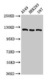 ACLY Antibody, FITC conjugated – Figure 1 of 4