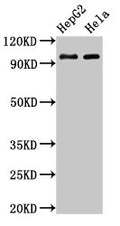 Western Blot
Positive WB detected in: HepG2 whole cell lysate, Hela whole cell lysate
All lanes: ACO1 antibody at 3µg/ml
Secondary
Goat polyclonal to rabbit IgG at 1/50000 dilution
Predicted band size: 99 kDa
Observed band size: 99 kDa
