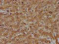 IHC image of CSB-PA001170LA01HU diluted at 1:100 and staining in paraffin-embedded human liver tissue performed on a Leica BondTM system. After dewaxing and hydration, antigen retrieval was mediated by high pressure in a citrate buffer (pH 6.0). Section was blocked with 10% normal goat serum 30min at RT. Then primary antibody (1% BSA) was incubated at 4°C overnight. The primary is detected by a biotinylated secondary antibody and visualized using an HRP conjugated SP system.