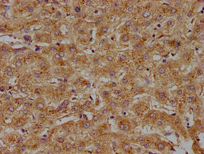 IHC image of CSB-PA001170LA01HU diluted at 1:100 and staining in paraffin-embedded human liver tissue performed on a Leica BondTM system. After dewaxing and hydration, antigen retrieval was mediated by high pressure in a citrate buffer (pH 6.0). Section was blocked with 10% normal goat serum 30min at RT. Then primary antibody (1% BSA) was incubated at 4°C overnight. The primary is detected by a biotinylated secondary antibody and visualized using an HRP conjugated SP system.