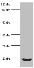 Western blot
All lanes: Low molecular weight phosphotyrosine protein phosphatase antibody at 4ug/ml + HepG2 whole cell lysate
Secondary
Goat polyclonal to rabbit IgG at 1/10000 dilution
Predicted band size: 19, 18, 15, 13 kDa
Observed band size: 19 kDa