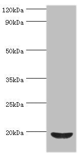 Western blot
All lanes: Low molecular weight phosphotyrosine protein phosphatase antibody at 4ug/ml + HepG2 whole cell lysate
Secondary
Goat polyclonal to rabbit IgG at 1/10000 dilution
Predicted band size: 19, 18, 15, 13 kDa
Observed band size: 19 kDa