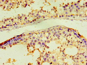 All lanes:CCND3 antibody at 1:1000
