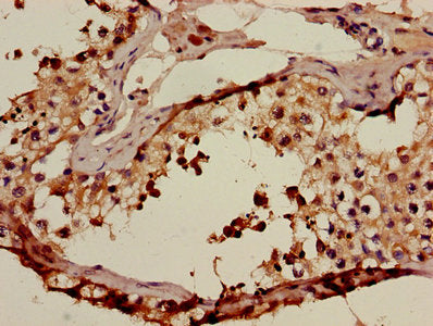 Immunohistochemistry of paraffin-embedded human testis tissue using CSB-PA001186HA01HU at dilution of 1:100