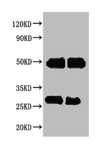 Rabbit anti-Human IgG Antibody – Figure 1 of 1