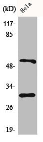 Western Blot analysis of HeLa cells using Caspase-10 B/C Polyclonal Antibody