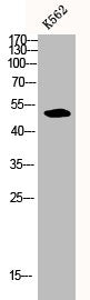Western Blot analysis of K562 cells using Caspase-2 Polyclonal Antibody