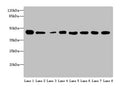 Western blot
All lanes: ACTL6A antibody at 4 ug/ml
Lane 1: Mouse thymus tissue
Lane 2: Mouse spleen tissue
Lane 3: Mouse heart tissue
Lane 4: Jurkats whole cell lysate
Lane 5: K562 whole cell lysate
Lane 6: Hela whole cell lysate
Lane 7: A549 whole cell lysate
Lane 8: MCF-7 whole cell lysate
Secondary
Goat polyclonal to rabbit IgG at 1/10000 dilution
Predicted band size: 48, 44 kDa
Observed band size: 48 kDa