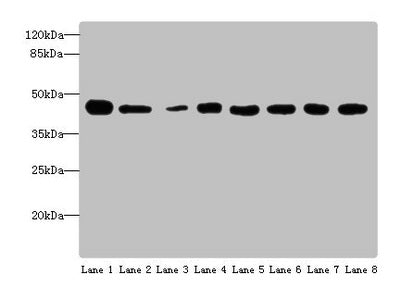 Western blot
All lanes: ACTL6A antibody at 4 ug/ml
Lane 1: Mouse thymus tissue
Lane 2: Mouse spleen tissue
Lane 3: Mouse heart tissue
Lane 4: Jurkats whole cell lysate
Lane 5: K562 whole cell lysate
Lane 6: Hela whole cell lysate
Lane 7: A549 whole cell lysate
Lane 8: MCF-7 whole cell lysate
Secondary
Goat polyclonal to rabbit IgG at 1/10000 dilution
Predicted band size: 48, 44 kDa
Observed band size: 48 kDa