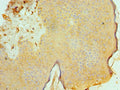 Immunohistochemistry of paraffin-embedded human skin tissue using CSB-PA001237ESR1HU at dilution of 1:100
