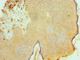 Immunohistochemistry of paraffin-embedded human skin tissue using CSB-PA001237ESR1HU at dilution of 1:100