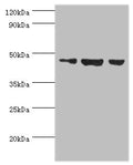 Western blot
All lanes: Actin-like protein 6B antibody at 3ug/ml
Lane 1: Hela whole cell lysate
Lane 2: U251 whole cell lysate
Lane 3: HepG2 whole cell lysate
Secondary
Goat polyclonal to rabbit IgG at 1/10000 dilution
Predicted band size: 47 kDa
Observed band size: 47 kDa