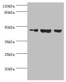 Western blot
All lanes: Actin-like protein 6B antibody at 3ug/ml
Lane 1: Hela whole cell lysate
Lane 2: U251 whole cell lysate
Lane 3: HepG2 whole cell lysate
Secondary
Goat polyclonal to rabbit IgG at 1/10000 dilution
Predicted band size: 47 kDa
Observed band size: 47 kDa