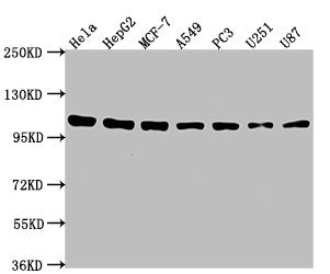 Western Blot
Positive WB detected in: Hela whole cell lysate, HepG2 whole cell lysate, MCF-7 whole cell lysate, A549 whole cell lysate, PC3 whole cell lysate, U251 whole cell lysate, U87 whole cell lysate
All lanes: ACTN1 antibody at 1:2000
Secondary
Goat polyclonal to rabbit IgG at 1/50000 dilution
Predicted band size: 104, 103, 106, 108 kDa
Observed band size: 104 kDa
