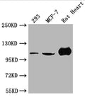 Western Blot
Positive WB detected in: 293 whole cell lysate, MCF-7 whole cell lysate, Rat Heart tissue
All lanes: ACTN2 antibody at 1:2000
Secondary
Goat polyclonal to rabbit IgG at 1/50000 dilution
Predicted band size: 104 kDa
Observed band size: 104 kDa