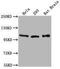 Western Blot
Positive WB detected in: Hela whole cell lysate, 293 whole cell lysate, Rat Brain tissue
All lanes: ACTN2 antibody at 1:2000
Secondary
Goat polyclonal to rabbit IgG at 1/50000 dilution
Predicted band size: 104 kDa
Observed band size: 104 kDa