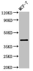 Western Blot
Positive WB detected in: MCF-7 whole cell lysate
All lanes: ACTR1A antibody at 1µg/ml
Secondary
Goat polyclonal to rabbit IgG at 1/50000 dilution
Predicted band size: 43 kDa
Observed band size: 43 kDa