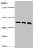 Western blot
All lanes: Alpha-centractin antibody at 8ug/ml
Lane 1: Mouse brain tissue
Lane 2: MCF-7 whole cell lysate
Lane 3: Mouse liver tissue
Secondary
Goat polyclonal to rabbit IgG at 1/10000 dilution
Predicted band size: 43 kDa
Observed band size: 43 kDa