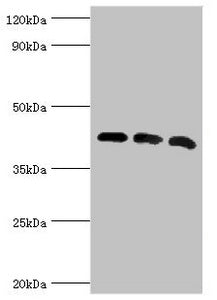 Western blot
All lanes: Alpha-centractin antibody at 8ug/ml
Lane 1: Mouse brain tissue
Lane 2: MCF-7 whole cell lysate
Lane 3: Mouse liver tissue
Secondary
Goat polyclonal to rabbit IgG at 1/10000 dilution
Predicted band size: 43 kDa
Observed band size: 43 kDa