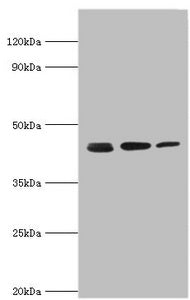 Western blot
All lanes: Actin-related protein 2 antibody at 3ug/ml
Lane 1: Mouse spleen tissue
Lane 2: Jurkat whole cell lysate
Lane 3: MCF-7 whole cell lysate
Secondary
Goat polyclonal to rabbit IgG at 1/10000 dilution
Predicted band size: 45, 46 kDa
Observed band size: 45 kDa