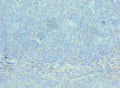 Immunohistochemistry of paraffin-embedded human tonsil tissue using CSB-PA001248ESR2HU at dilution of 1:100