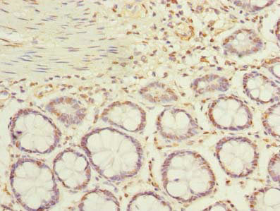 ACTRT1 Antibody, FITC conjugated – Figure 1 of 5