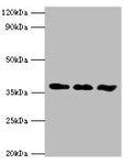 Western blot All lanes: ACVR1 antibody at 6ug/ml Lane 1: A549 whole cell lysate Lane 2: HepG2 whole cell lysate Lane 3: Mouse gonad tissue Secondary Goat polyclonal to rabbit IgG at 1/10000 dilution Predicted band size: 39 kDa Observed band size: 39 kDa