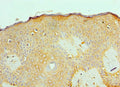 Immunohistochemistry of paraffin-embedded human skin tissue using CSB-PA001260ESR1HU at dilution of 1:100