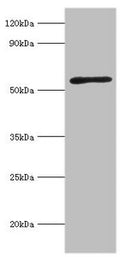 Western blot
All lanes: Activin receptor type-2A antibody at 3ug/ml + Mouse brain tissue
Secondary
Goat polyclonal to rabbit IgG at 1/10000 dilution
Predicted band size: 58, 46 kDa
Observed band size: 58 kDa