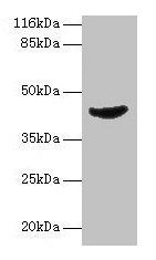 ADA Antibody, Biotin conjugated – Figure 1 of 4
