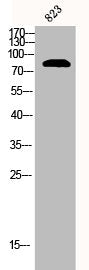Western Blot analysis of 823 cells using Catenin-β Polyclonal Antibody