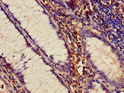 ADAM10 Antibody, FITC conjugated – Figure 1 of 3
