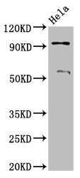 Western Blot
Positive WB detected in: Hela whole cell lysate
All lanes: ADAM23 antibody at 3.2µg/ml
Secondary
Goat polyclonal to rabbit IgG at 1/50000 dilution
Predicted band size: 92, 93 kDa
Observed band size: 92 kDa