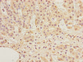 Immunohistochemistry of paraffin-embedded human adrenal gland tissue using CSB-PA001297LA01HU at dilution of 1:100
