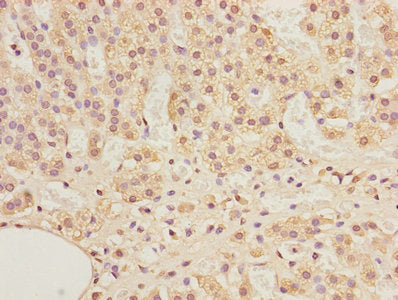 ADAMDEC1 Antibody, FITC conjugated – Figure 1 of 1