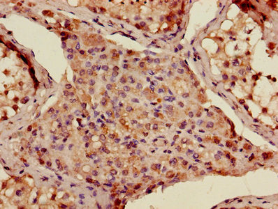 Immunohistochemistry of paraffin-embedded human testis tissue using CSB-PA001300LA01HU at dilution of 1:100