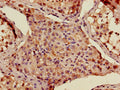 ADAMTS12 Antibody, FITC conjugated – Figure 1 of 1