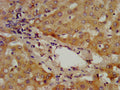 IHC image of CSB-PA001301LA01HU diluted at 1:400 and staining in paraffin-embedded human liver tissue performed on a Leica BondTM system. After dewaxing and hydration, antigen retrieval was mediated by high pressure in a citrate buffer (pH 6.0). Section was blocked with 10% normal goat serum 30min at RT. Then primary antibody (1% BSA) was incubated at 4&deg;C overnight. The primary is detected by a biotinylated secondary antibody and visualized using an HRP conjugated SP system.