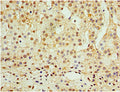 Immunohistochemistry of paraffin-embedded human adrenal gland tissue using CSB-PA001322DSR1HU at dilution of 1:100