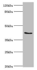 Western blot
All lanes: ADAP1 antibody at 2µg/ml + Rat brain tissue
Secondary
Goat polyclonal to rabbit IgG at 1/10000 dilution
Predicted band size: 44, 45, 36 kDa
Observed band size: 44 kDa