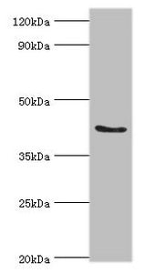 Western blot
All lanes: ADAP1 antibody at 2µg/ml + Rat brain tissue
Secondary
Goat polyclonal to rabbit IgG at 1/10000 dilution
Predicted band size: 44, 45, 36 kDa
Observed band size: 44 kDa