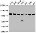 Western Blot
Positive WB detected in: Hela whole cell lysate, 293T whole cell lysate, Jurkat whole cell lysate, HepG2 whole cell lysate, U87 whole cell lysate, A549 whole cell lysate, LO2 whole cell lysate
All lanes: ADAR antibody at 1:2000
Secondary
Goat polyclonal to rabbit IgG at 1/50000 dilution
Predicted band size: 137, 134, 132, 141, 104 kDa
Observed band size: 104 kDa
