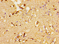Immunohistochemistry of paraffin-embedded human brain tissue using CSB-PA001344LA01HU at dilution of 1:100